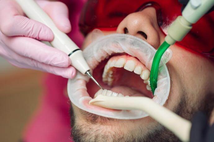 Best Dental Clinic in Madhapur Best Dental Clinic in Madhapur