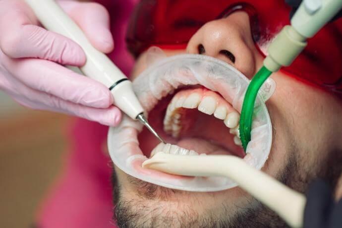 Best Dental hospital in Kukatpally