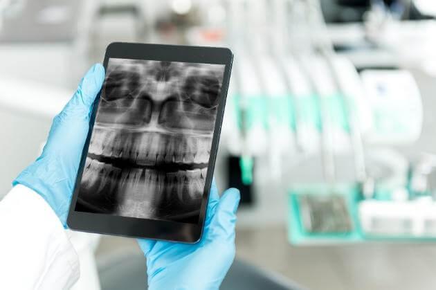 digital imaging cost in Hyderabad digital imaging cost in Hyderabad