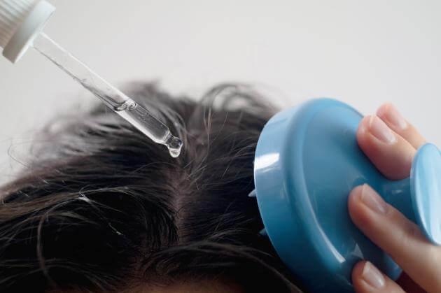 Best Scalp treatment in Hyderabad Best Scalp treatment in Hyderabad