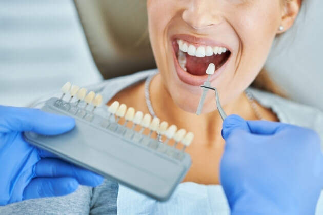 Teeth Whitening Treatment in Hyderabad Teeth Whitening Treatment in Hyderabad