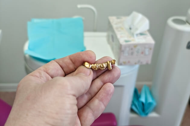 Best Dental Crowns in Hyderabad Best Dental Crowns in Hyderabad