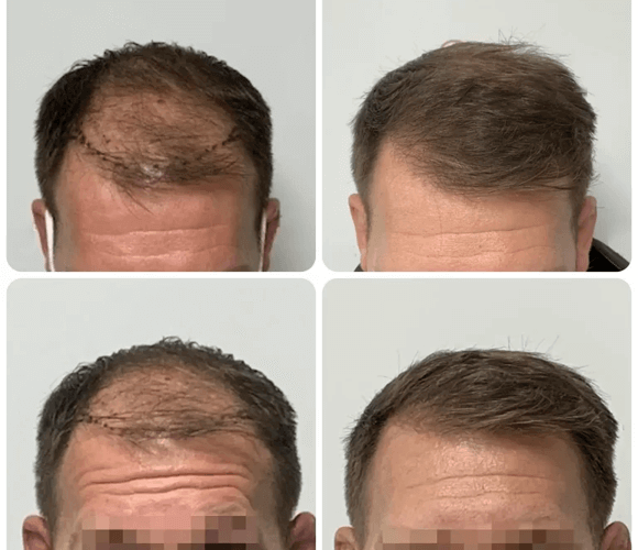 Best Dental Clinic in Hyderabad